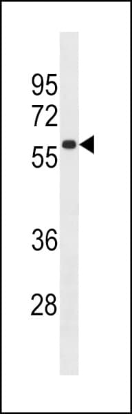 TBKBP1 Antibody (aa470-497)