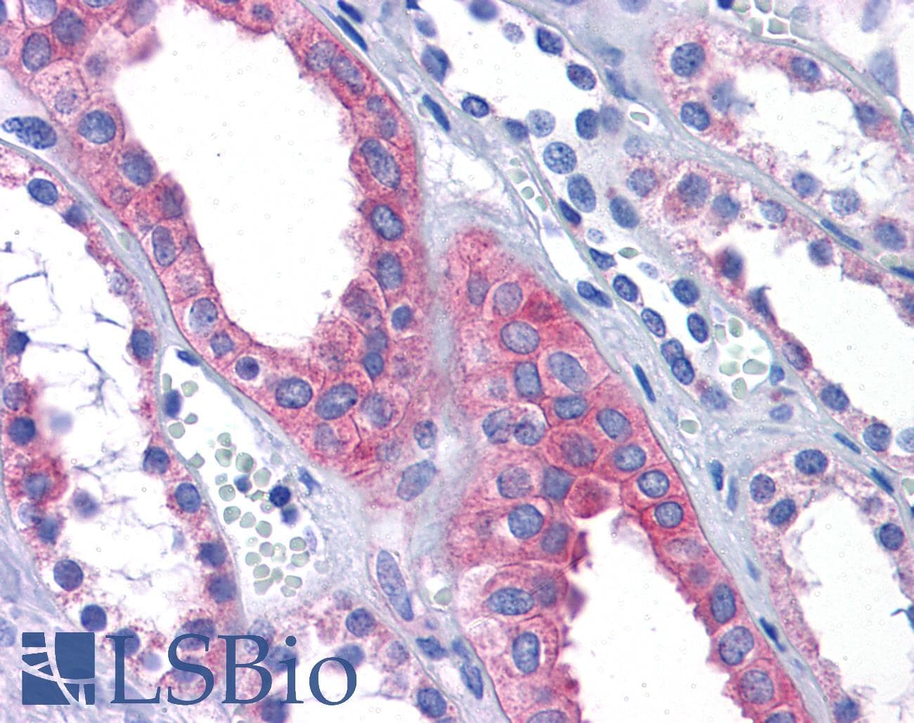 IHC-plus™ AFAP1L2 / XB130 Antibody