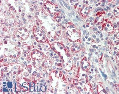 IHC-plus™ MAP3K11 / MLK3 Antibody
