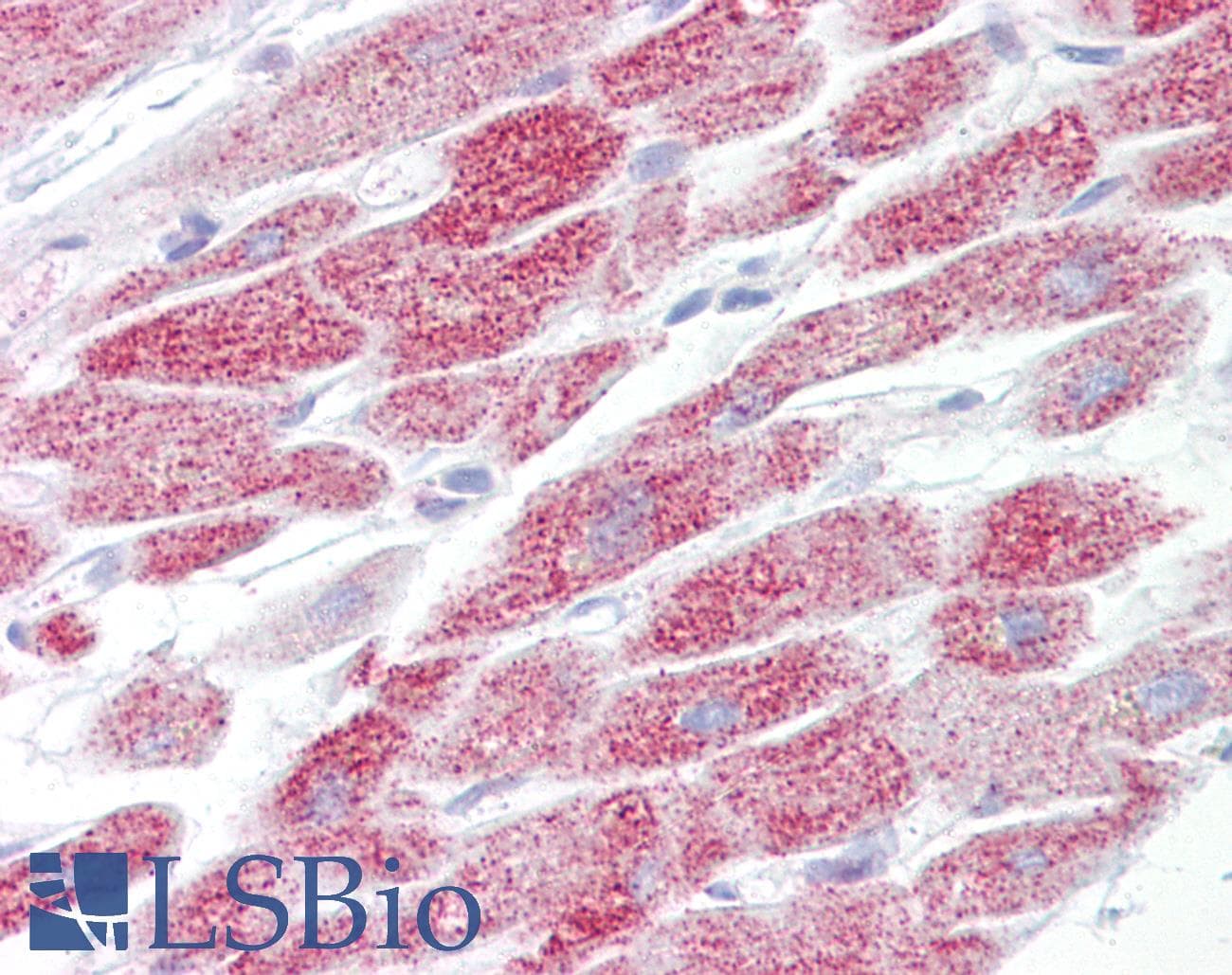 IHC-plus™ DISPA / DISP1 Antibody