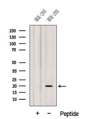 Polyclonal Rabbit anti-Human GEMIN6 / Gemin-6 Antibody (WB)