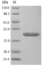 Mouse USAG1 / SOSTDC1 Protein (Recombinant 10His, N-terminus + Myc, C-terminus)
