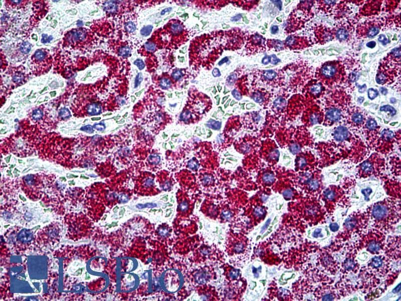 IHC-plus™ Monoclonal Mouse anti-Human CPS1 Antibody (clone 8H8, IHC, WB)