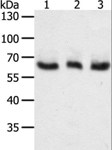 Tyrosinase Antibody