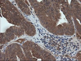 TCL / RHOJ Antibody (clone OTI1C8)