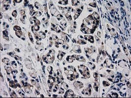 CTNNB1 / Beta Catenin Antibody (clone OTI9F6)
