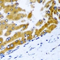 GPD2 Antibody