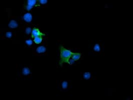MAP2K1 / MKK1 / MEK1 Antibody (clone OTI3H5)