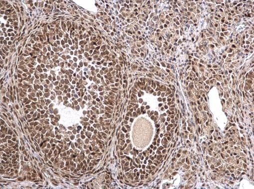 MTA1 Antibody (aa391-708)