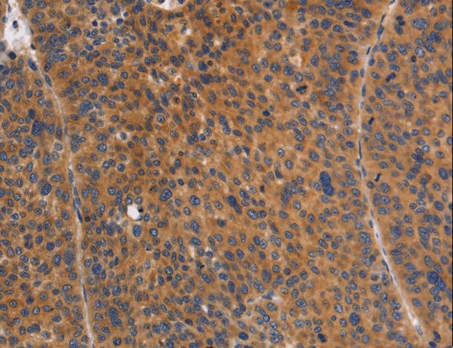 NOD1 Antibody