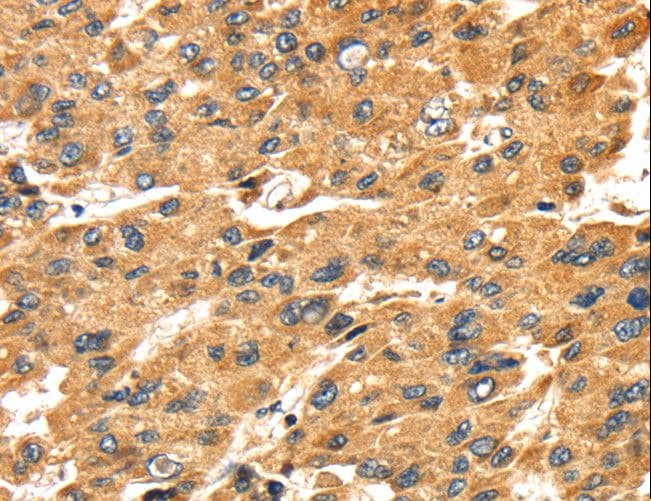 Polyclonal Rabbit anti-Human SH3KBP1 / CIN85 Antibody (IHC)
