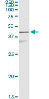 IHC-plus™ KRT17 / CK17 / Cytokeratin 17 Antibody (clone 2D4-1G9)