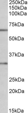 CASP3 / Caspase 3 Antibody (aa101-112)