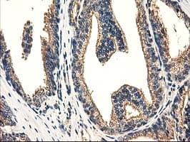 CAT / Catalase Antibody (clone OTI1B8)