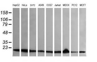 UBE2G2 Antibody (clone OTI5F1)
