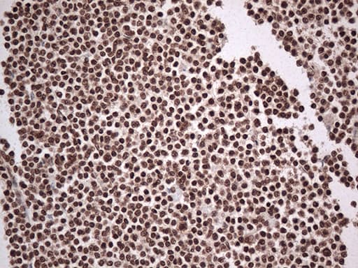 EWSR1 / EWS Antibody (aa256-447, clone OTI2G3)