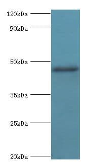 SHFM3 / FBXW4 Antibody (aa143-412)