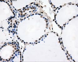 ATP5B / ATP Synthase Beta Antibody (clone OTI6C4)