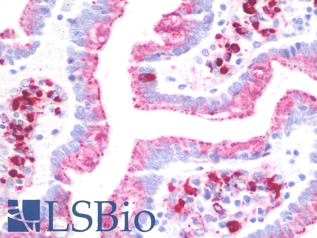 IHC-plus™ MAC-2-BP / LGALS3BP Antibody (clone 2B1)