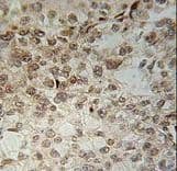 Polyclonal Rabbit anti-Human IFT43 / C14orf179 Antibody (aa145-171, IHC, WB)