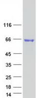 Human ARSE / Arylsulfatase E Protein (Recombinant Myc-DDK (Flag))