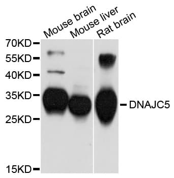 Polyclonal Rabbit anti-Human DNAJC5 / CSP Antibody (WB)