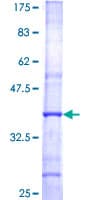Human GCNT2 Protein (Recombinant GST, N-terminus)