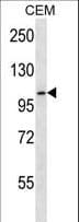 RHBDF2 Antibody (aa80-109)