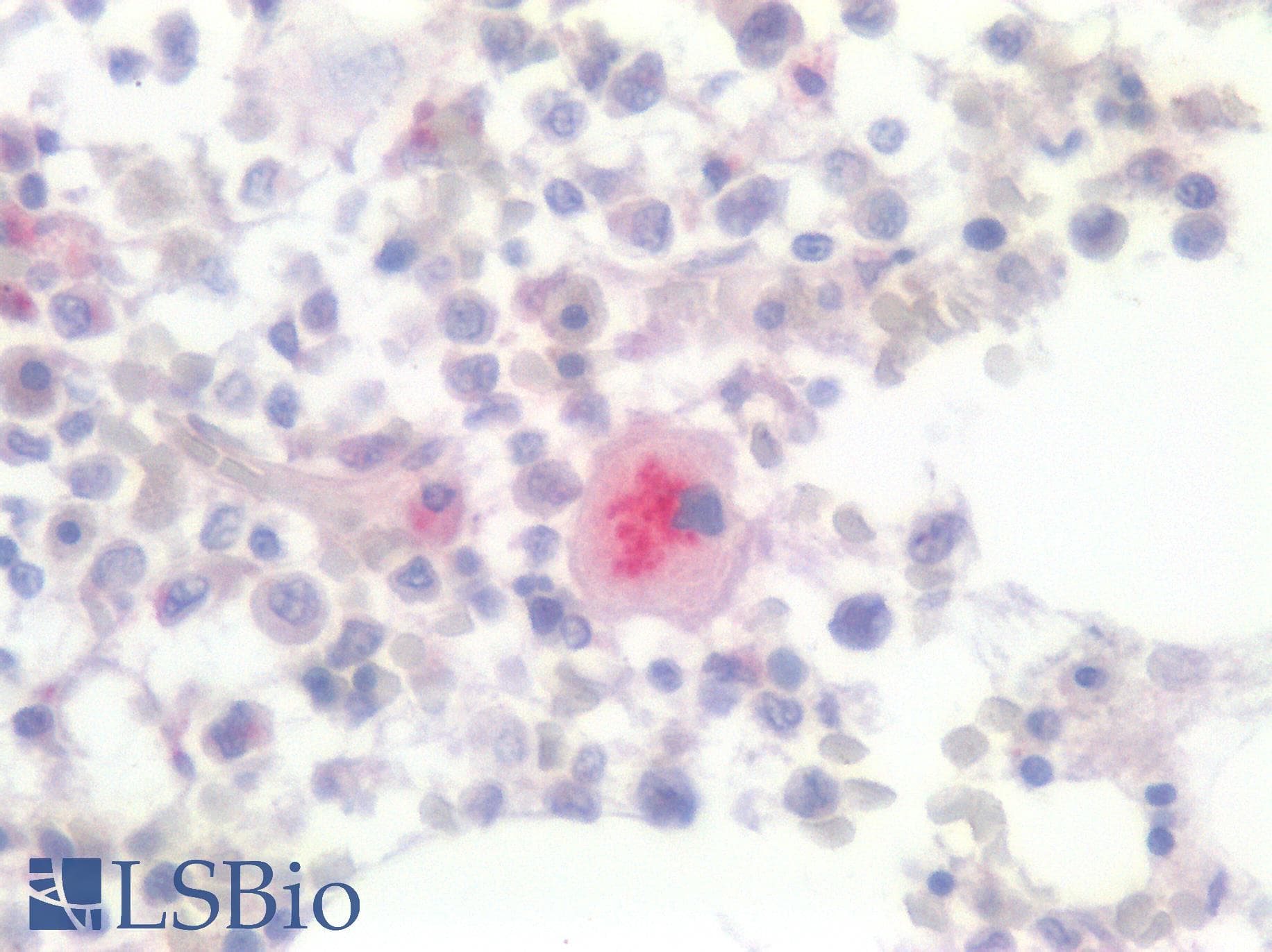 PathPlus™ Polyclonal Rabbit anti-Human CD36 Antibody (IHC)