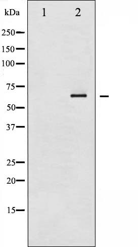 RELA / NFKB p65 Antibody (phospho-Ser536)