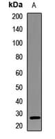 Polyclonal Rabbit anti-Human RAD9A / RAD9 Antibody (IHC, IF, WB)