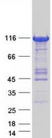 Human PHKA1 Protein (Recombinant Myc-DDK (Flag))