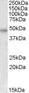 IHC-plus™ F2R / Thrombin Receptor / PAR1 Antibody (aa24-37)