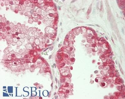 IHC-plus™ OXSR1 / OSR1 Antibody (aa375-425)