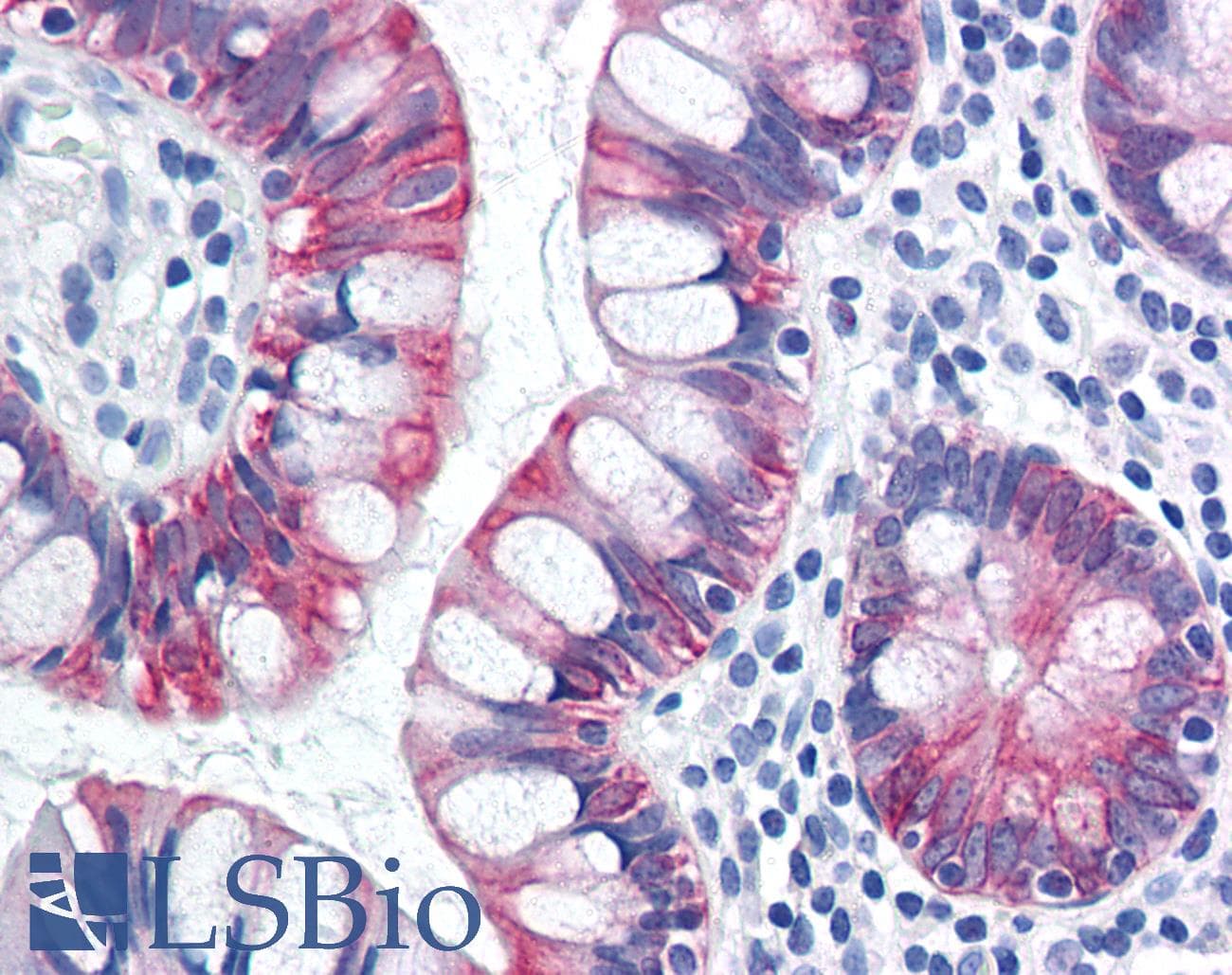 IHC-plus™ KRT18 / CK18 / Cytokeratin 18 Antibody (C-Terminus)