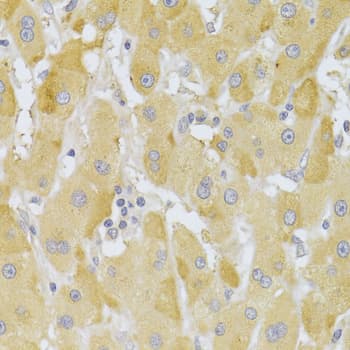 Polyclonal Rabbit anti-Human SNAI2 / SLUG Antibody (IHC, IF, WB)
