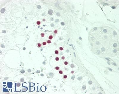 IHC-plus™ SSX2 Antibody (clone 1A4)