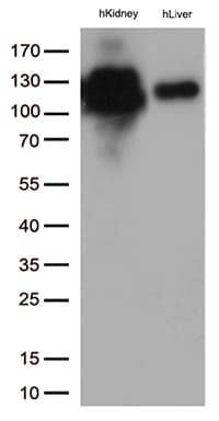 MME / CD10 Antibody (aa411-750, clone UMAB235)