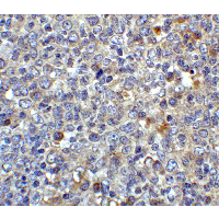 CD80 Antibody