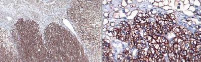 CA9 / Carbonic Anhydrase IX Antibody (C-Terminus, DY488)