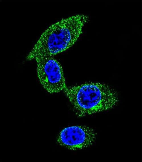 Polyclonal Rabbit anti-Human SORBS1 / Ponsin Antibody (aa866-892, IF, WB)