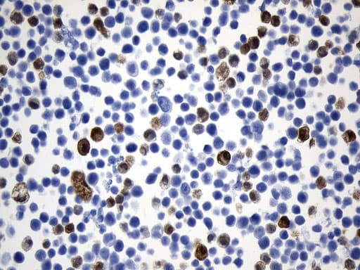 UCHL1 / PGP9.5 Antibody (clone UMAB244)
