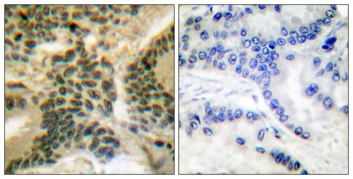 PRKCZ / PKC-Zeta Antibody (phospho-Thr410)