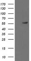 Monoclonal Mouse anti-Human TP53 / p53 Antibody (clone OTI3D5, IHC, IF, WB)
