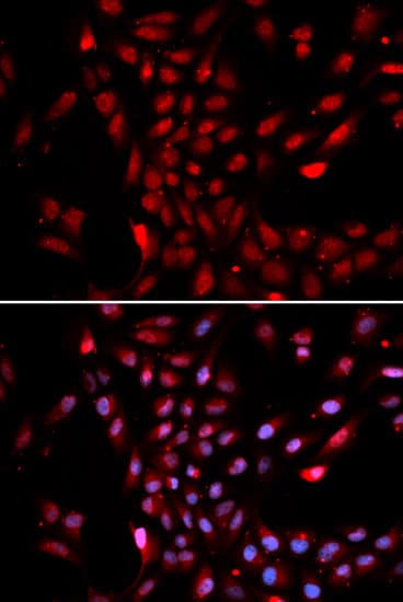 QIP1 / KPNA4 Antibody