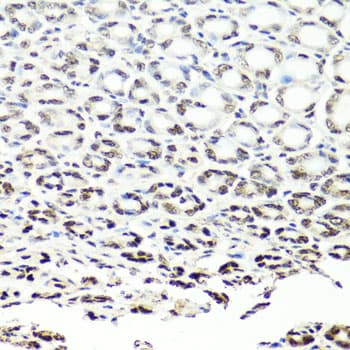 Polyclonal Rabbit anti-Human NUMA1 / NUMA Antibody (IHC, IF, WB)