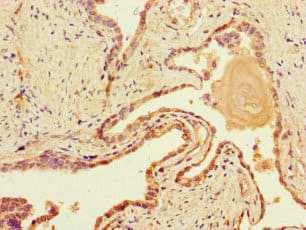 Polyclonal Rabbit anti-Human DNAH1 Antibody (IHC, IF)