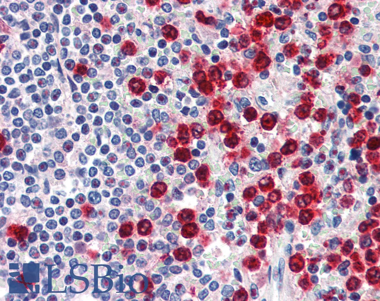 IHC-plus™ MPO / Myeloperoxidase Antibody