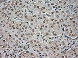 Monoclonal Mouse anti-Human BUB1B / BubR1 Antibody (clone OTI10B7, IHC, IF, WB)