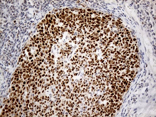 Monoclonal Mouse anti-Human RFC3 Antibody (clone OTI3F6, IHC, WB)
